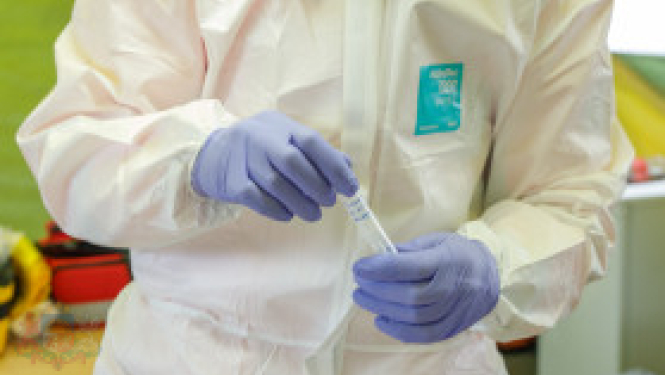 Veselības ministrija: jāizvērtē, vai cilvēkam Covid-19 tests ir steidzami nepieciešams